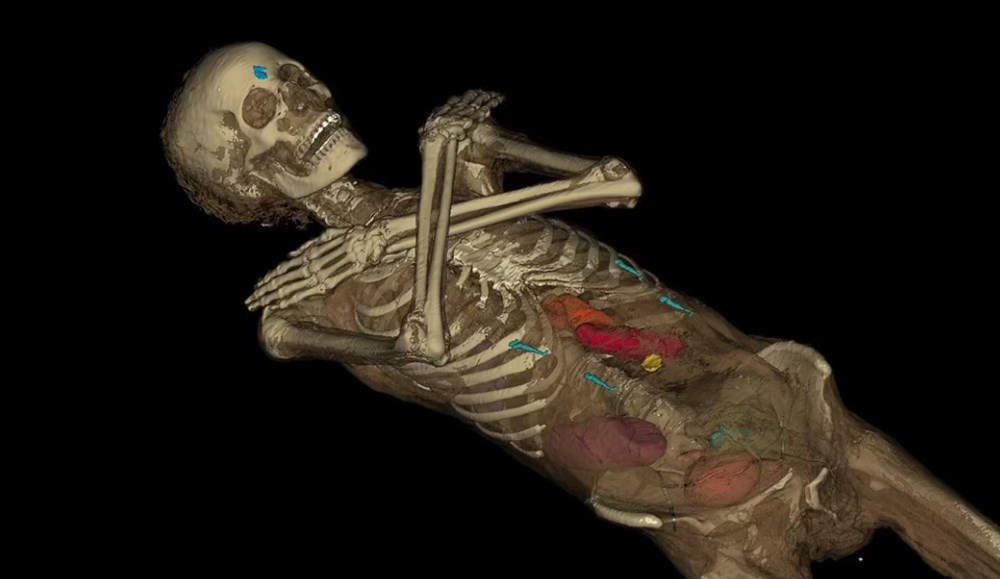 Gizemli “Hamile mumya” 2 bin yıl sonra tarihe ışık tutacak! 6 Hamile mumya 2 bin yıl sonra geri döndü: "Gizemli Kadın" tarihe ışık tutacak - 7