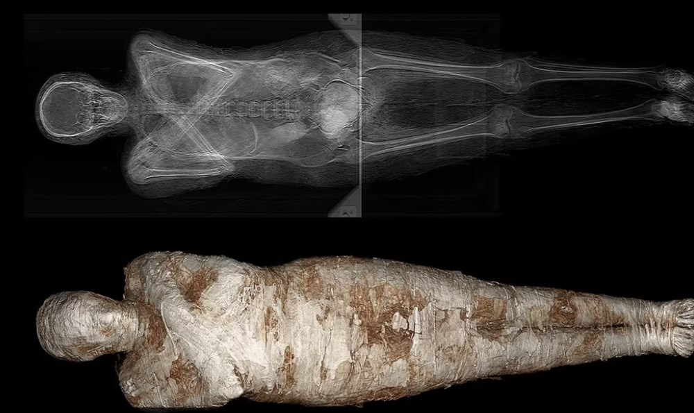 Gizemli “Hamile mumya” 2 bin yıl sonra tarihe ışık tutacak! 5 Hamile mumya 2 bin yıl sonra geri döndü: "Gizemli Kadın" tarihe ışık tutacak - 6