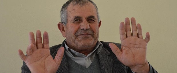 24 parmağıyla herkesi şaşırtıyor.jpg
