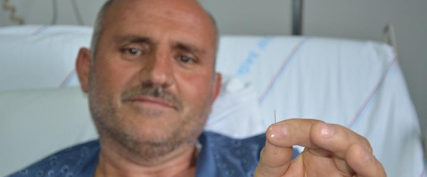 Akciğerinden 'dikiş iğnesi' çıktı.jpg