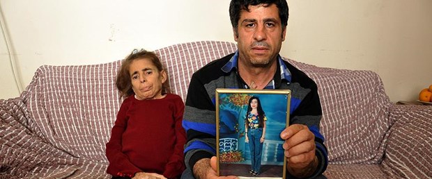 Hastalığı nedeniyle adeta eriyor.jpg