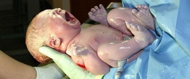 Zika virüsü beyin hücrelerini küçültüyor.jpg