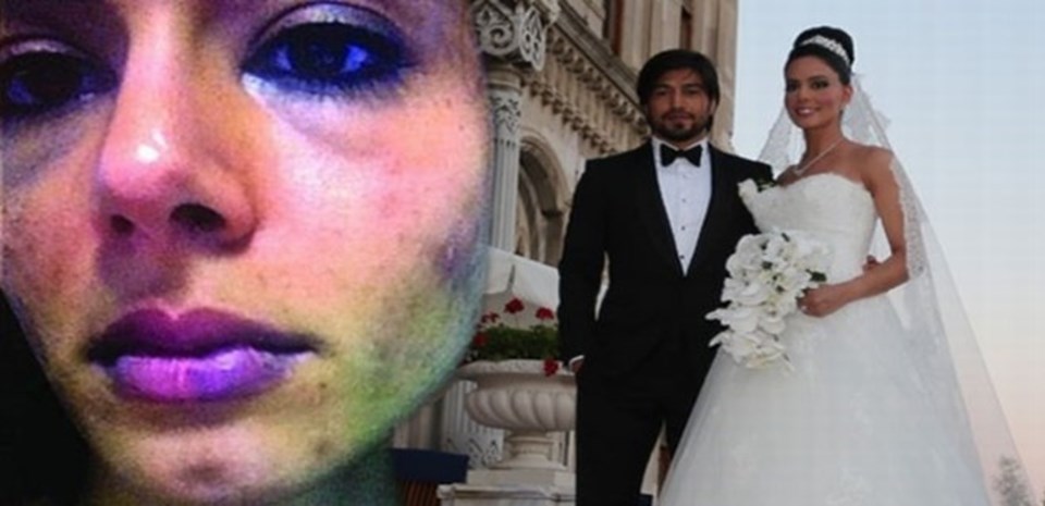 Eylem Toraman eşinden dayak yediğini iddia ederek fotoğraflarını delil olarak sunmuştu.