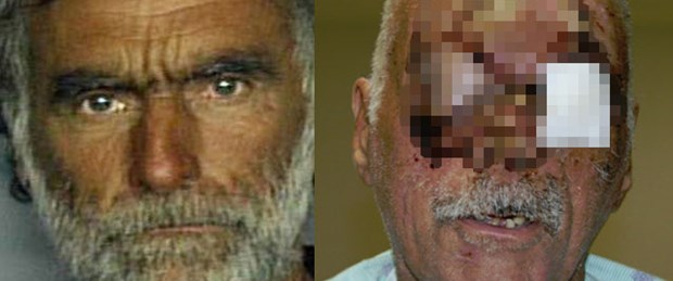 'Yamyam'ın yediği adamın ilk görüntüleri