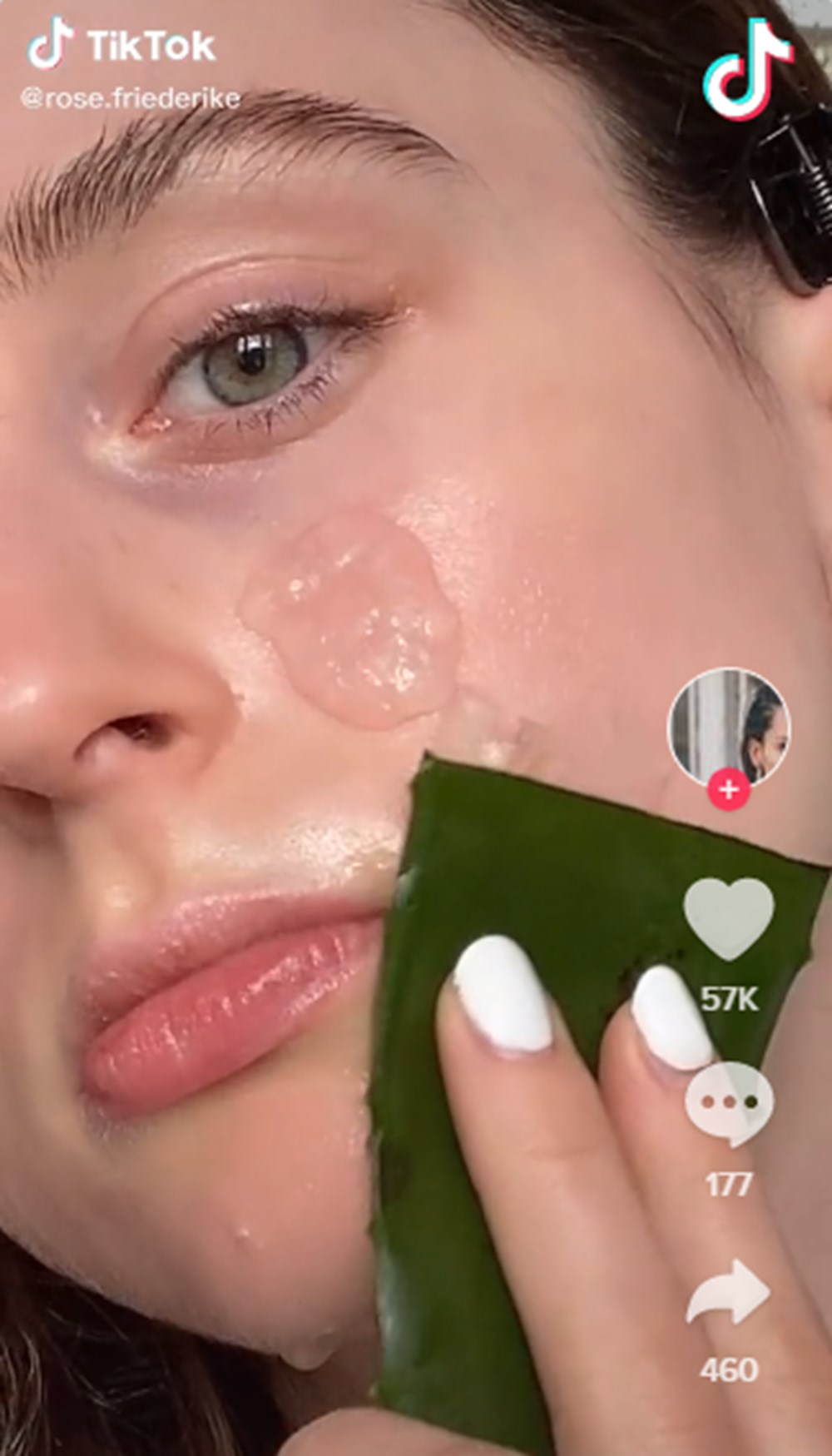 Güneş yanığına iyi gelen en doğal çözümler - 8