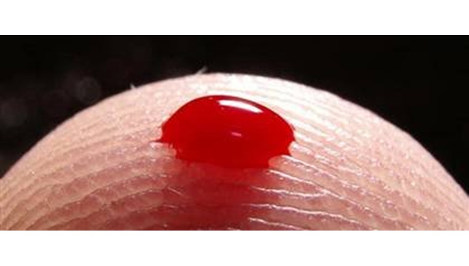Ciddi bir kanama hastalığı: Hemofili