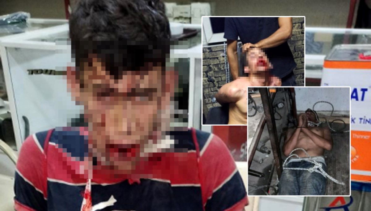 İşçiye korkunç işkence: Üç gün dövdüler, dişlerini kırıp, böcek yedirdiler İşçiye korkunç işkence: Üç gün dövdüler, dişlerini kırıp, böcek yedirdiler