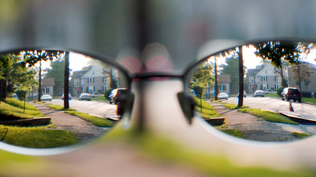 Miyoplarin Gozunden Dunya