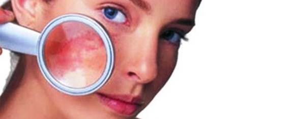 Kilcal Damar Catlamasina Altin Igne Dokunusu Saglik Haberleri Ntv Kilcal Damar Catlamasina Altin Igne Dokunusu Saglik Haberleri Ntv