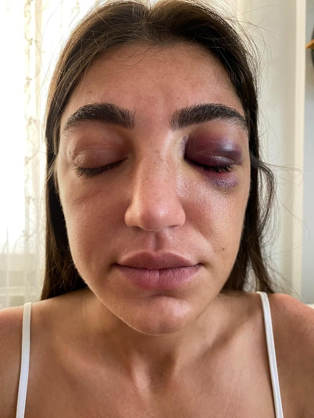 Model Gizem Akbaş'a öldüresiye dayak (Mücahit İsmail Ayta tutuklandı) - 5