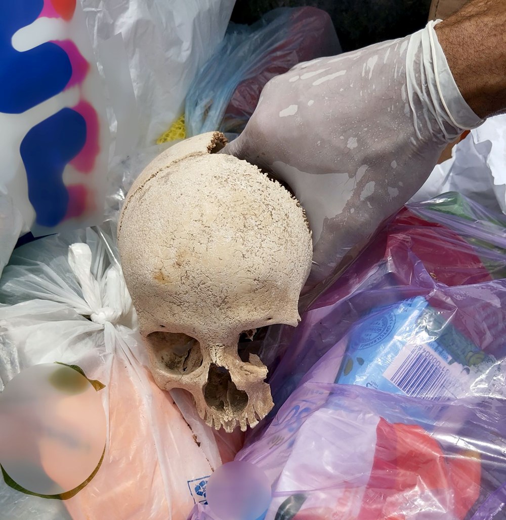 Sitenin çöpünden kafatası çıktı: Bir çocuğa ilişkin olduğu düşünülüyor 74 0LDEE7aXo0eUT7XmHF7e6Q