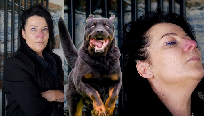 Arkadaşının köpeği burnunu parçaladı
