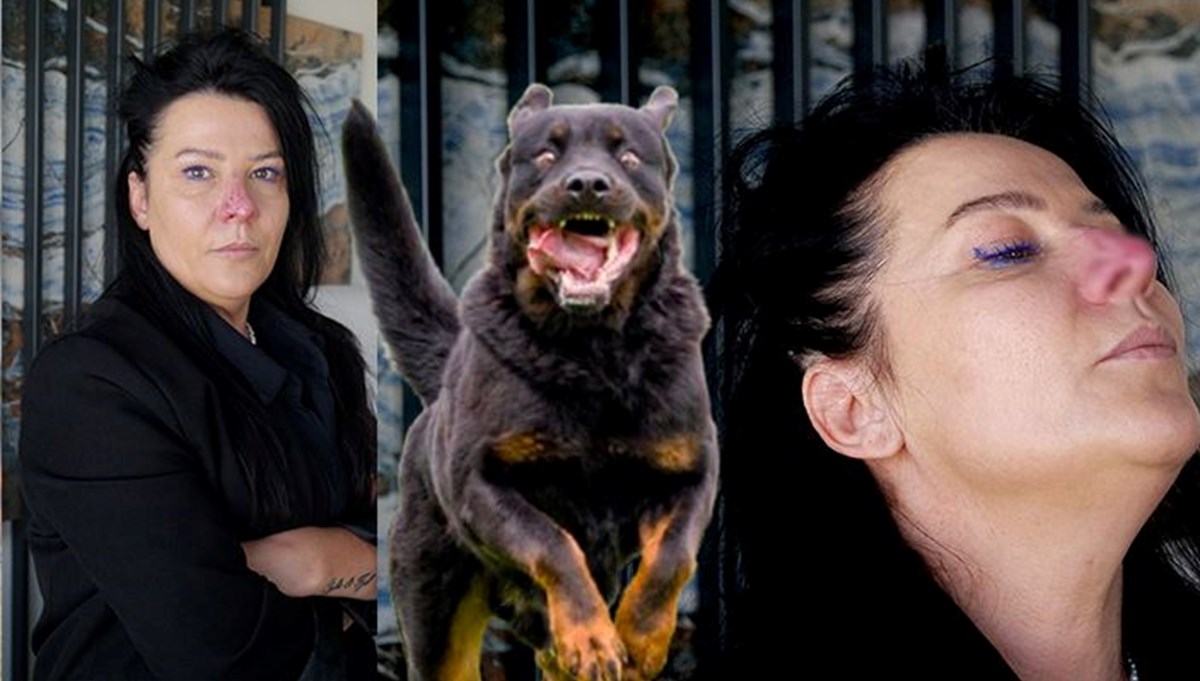 Arkadaşının köpeği burnunu parçaladı Arkadaşının köpeği burnunu parçaladı