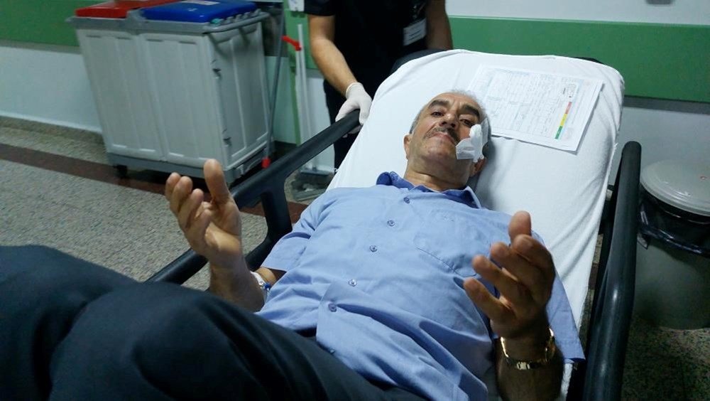 Maganda kurşunuyla yanağından vuruldu - 4