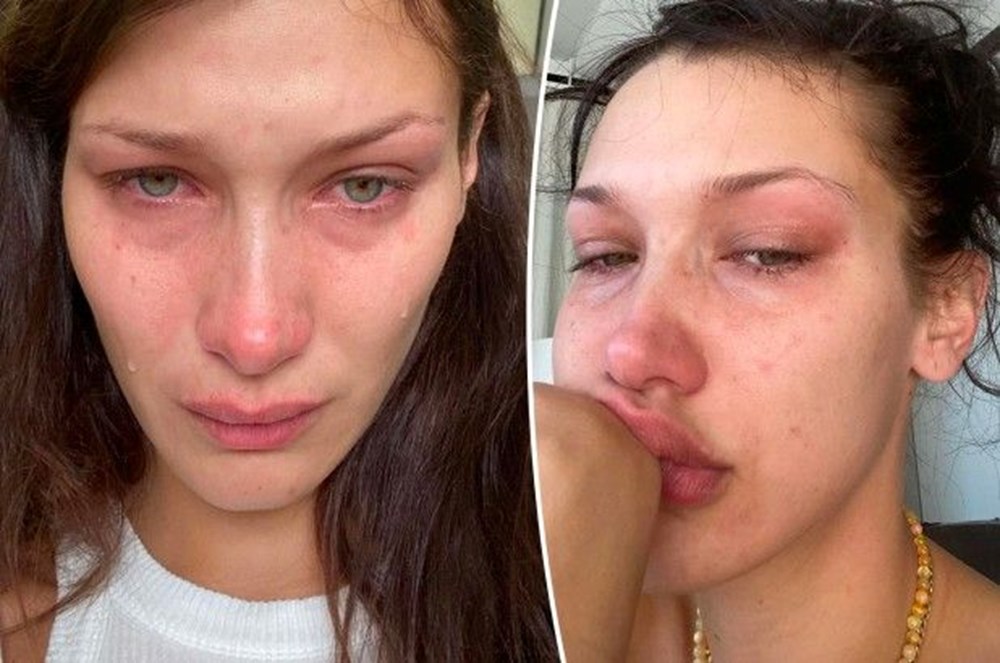 Bella Hadid: Ruh sağlığım için stilistimi bıraktım - 5