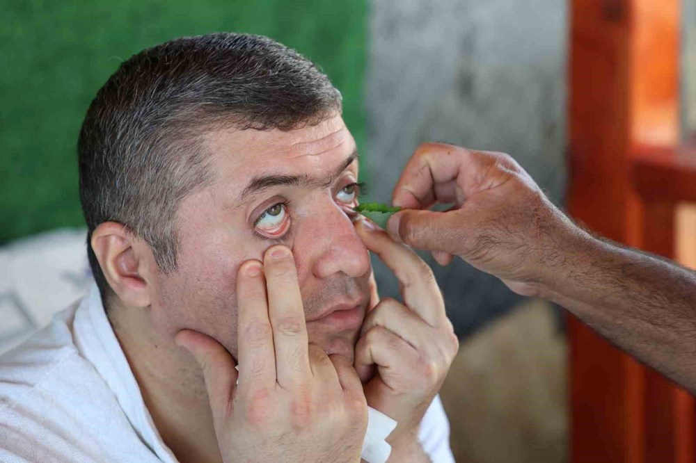 "Gözlük kırdıran otu" olarak biliniyor: Bu mucizevi bitki, göz kuruluğunu gideriyor, iltihapları yok ediyor - 3