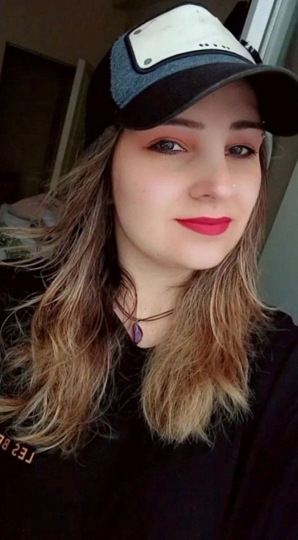 Defalarca bıçakladı, ölmesi için başında bekledi! Mucize kadın yaşadığı dehşeti anlattı - 3