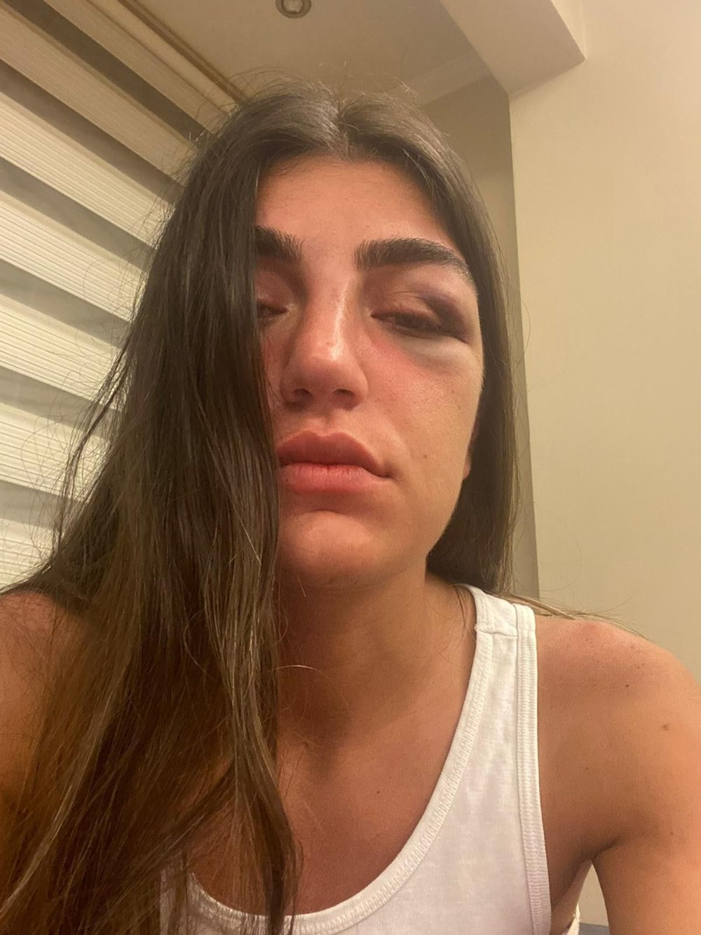 Model Gizem Akbaş'a öldüresiye dayak (Mücahit İsmail Ayta tutuklandı) - 3