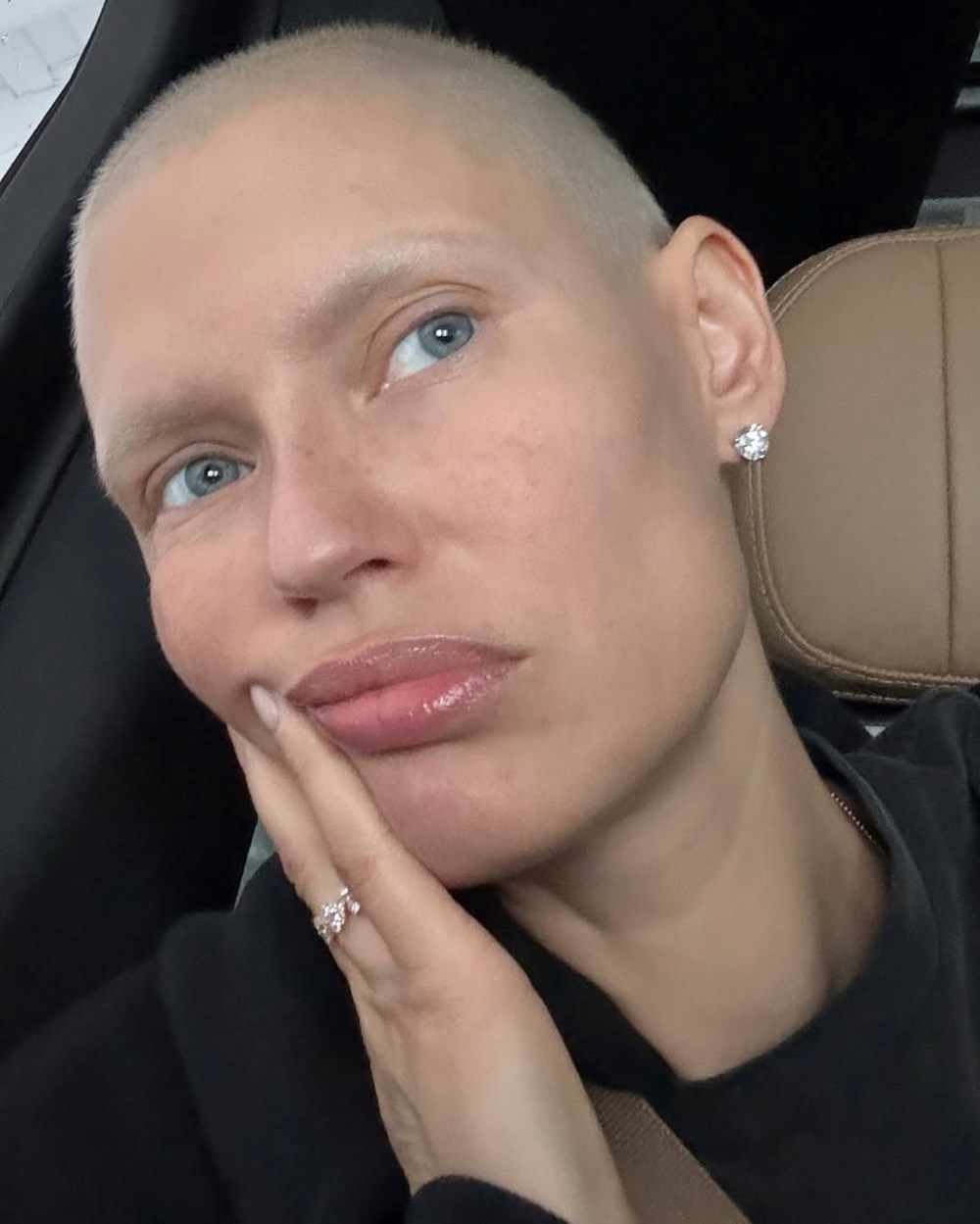 Ünlü model Bianca Balti kanserle savaşıyor: Victoria's Secret teklifimi reddetti - 4