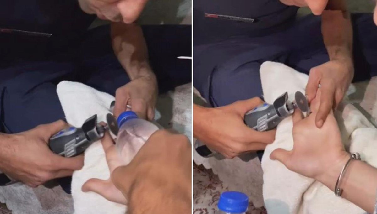 İtfaiyeden yüzük çıkarma operasyonu