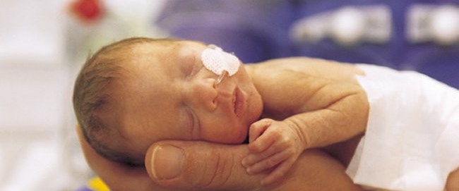 Новорожденный только родился. Ребенок родился как развивается. Этапы развития малыша. Ребенок родился как развивается. Задержка внутриутробного развития дети.