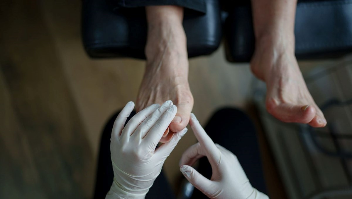 Ayaklardaki bu işaret ölümcül hastalığın habercisi olabilir