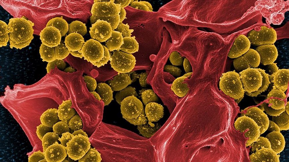 DSÖ'den süper bakteri uyarısı: Süper bakteri nedir, bulaşıcı mı, Türkiye'de görüldü mü? - 7