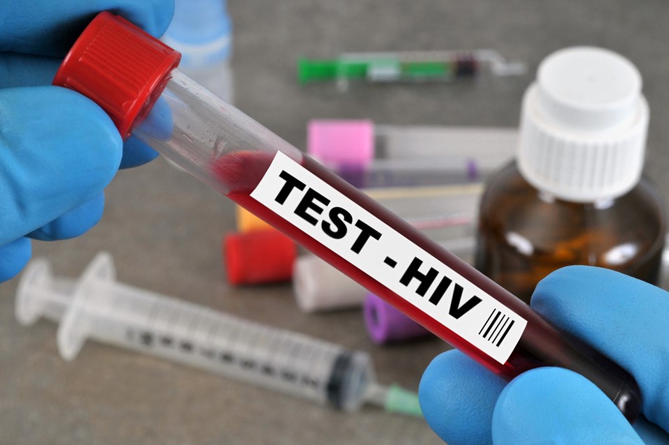 AIDS nedir, HIV testi ne zaman yapılmalı? (“Türkiye’de binlerce kişi HIV pozitif olduğundan haberdar değil”) - 2