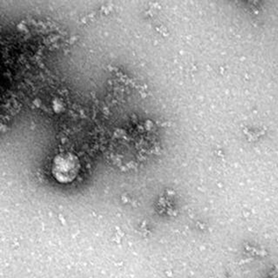 Rusya'da corona virüsün Delta Plus mutasyonu görüntülendi - 1