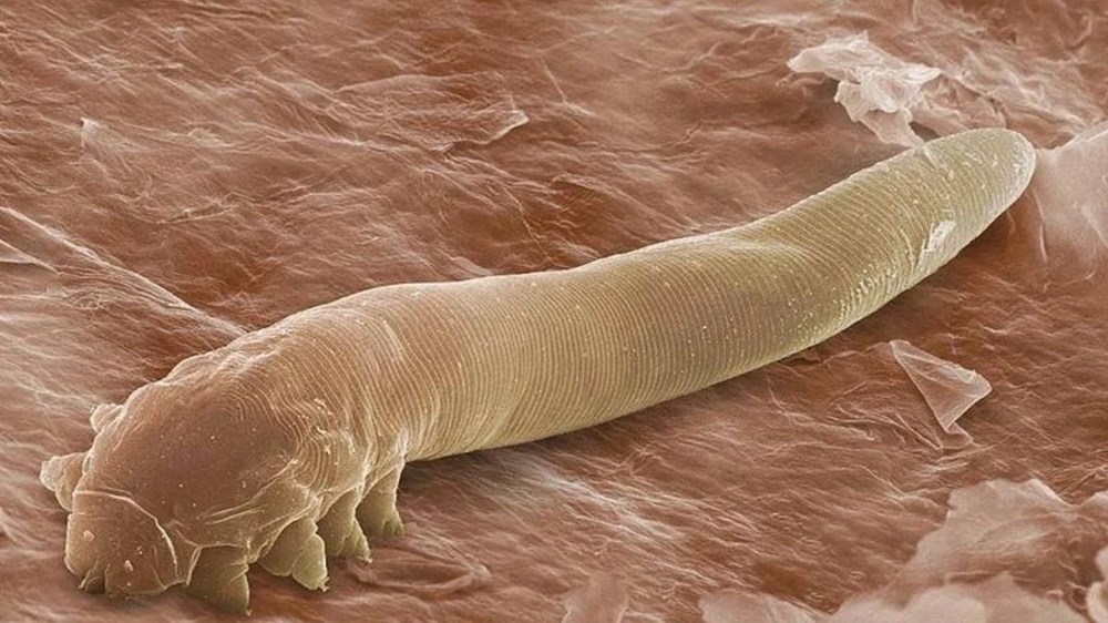 İnsan yüzünde yüzbinlerce akar yaşıyor: Demodex nedir? - 5