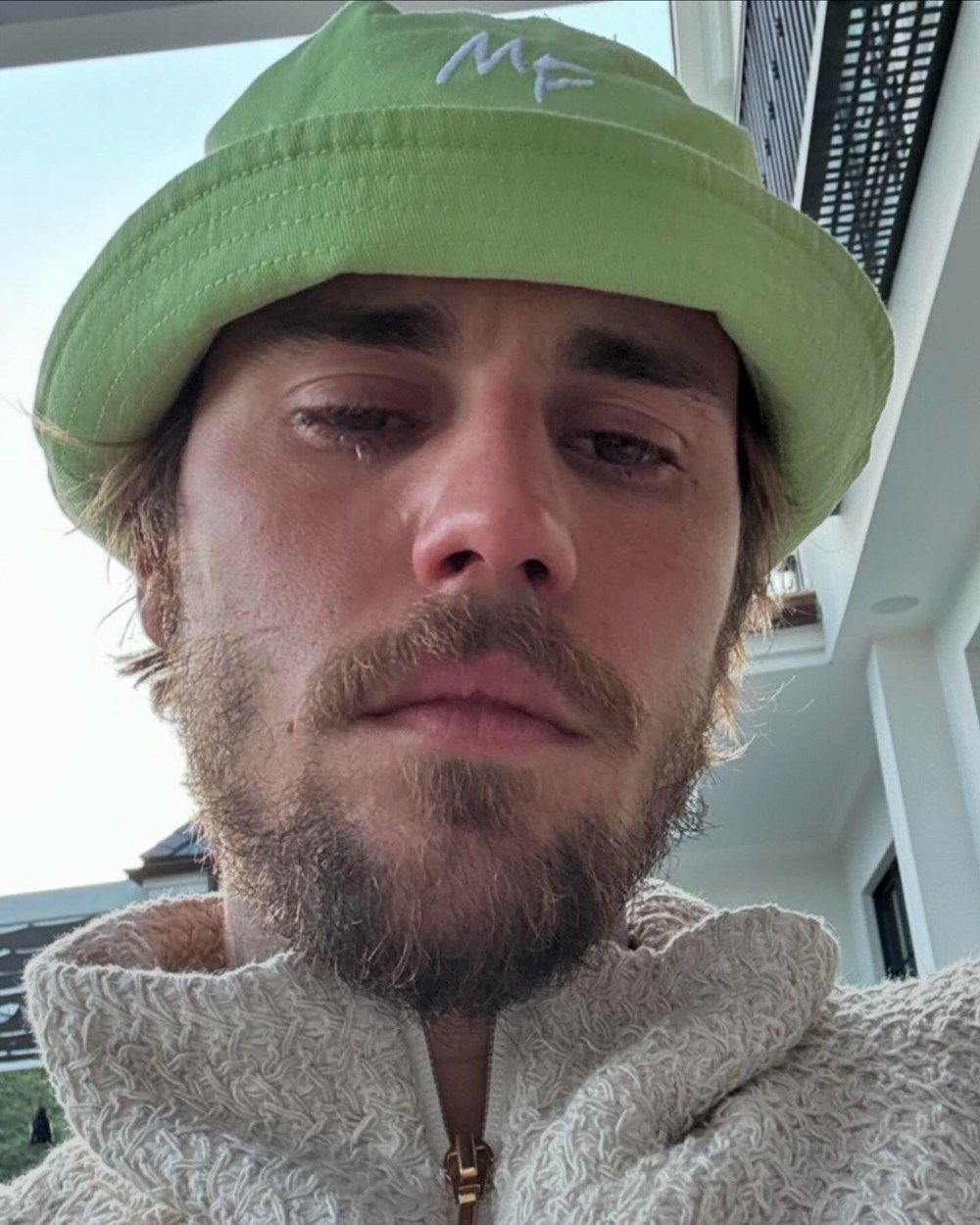 Justin Bieber'ın o fotoğrafları hayranlarını endişelendirdi - 3