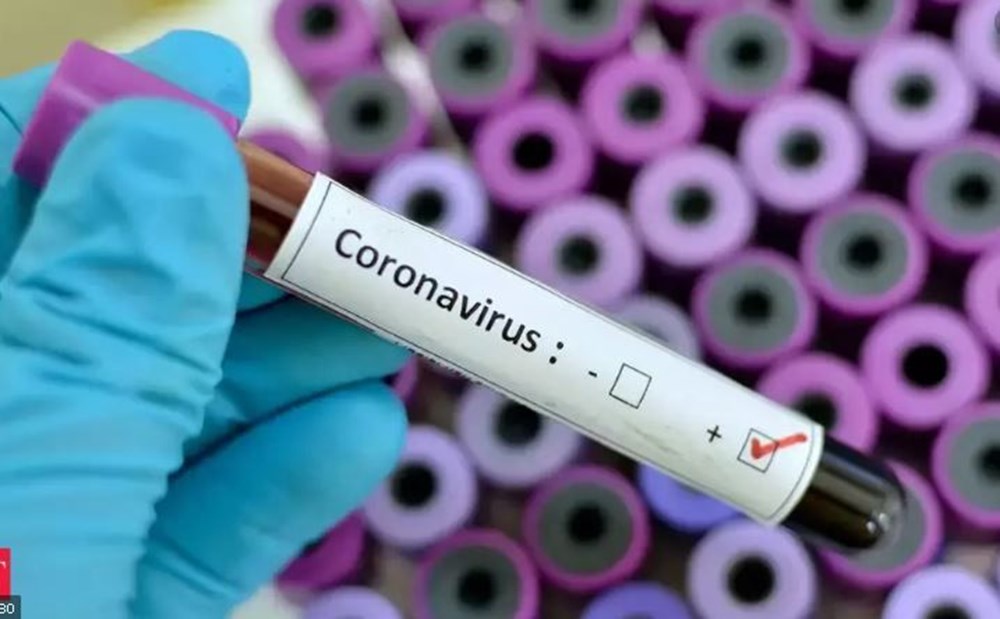 Antikor testi nedir? (Corona virüs ve antikor testleri hakkında sık sorulan sorular ve cevapları) - 5