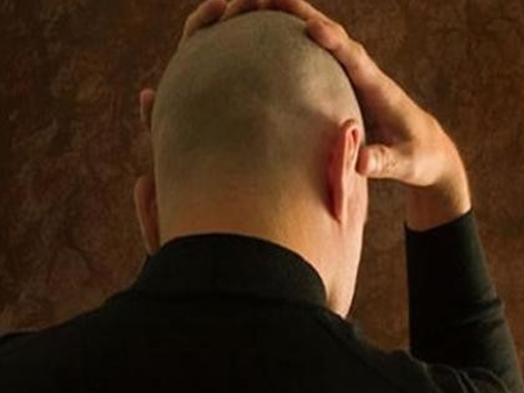 Kellige Karsi Sac Klonlama Saglik Haberleri Ntv