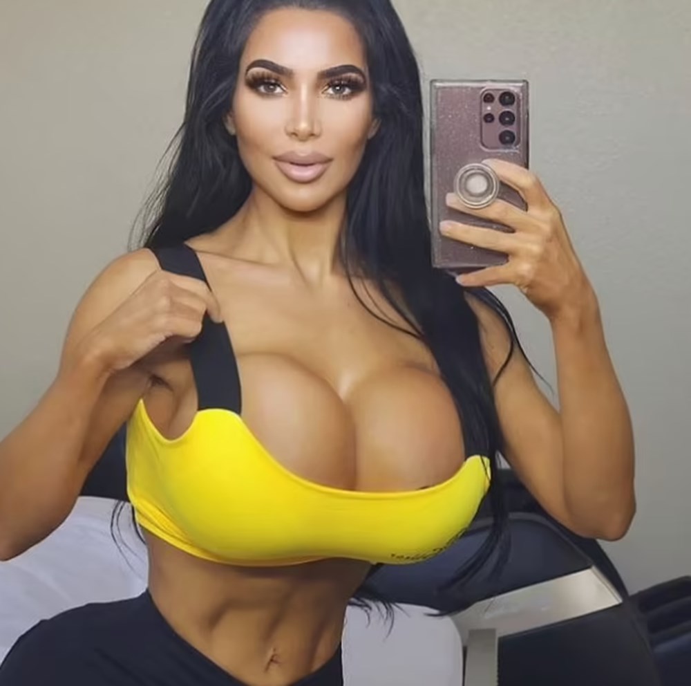 Kim Kardashian’a benzemek için defalarca ameliyat oldu: 34 yaşında hayatını kaybetti - 2