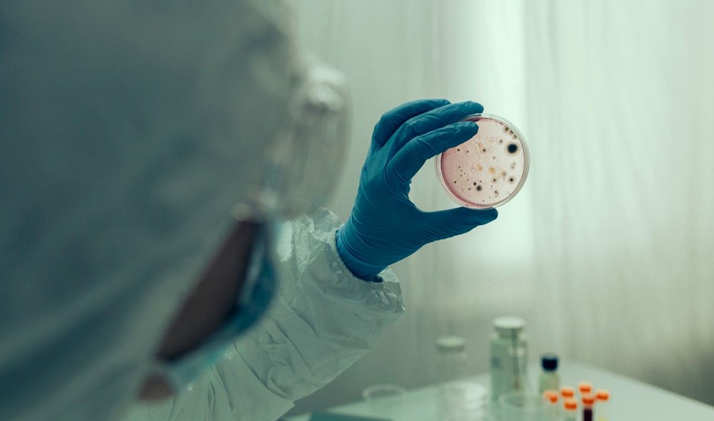 Tehlikeli virüs yeniden hortladı: Enfekte olanların yüzde 50'sini öldürüyor - 6