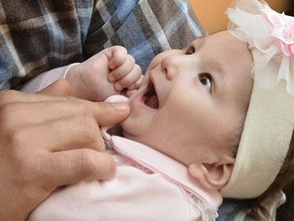 miyavlama sendromu nedir