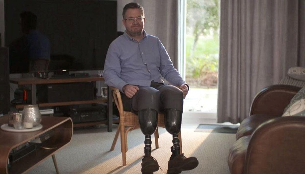 İngiltere'de cerrah soruşturması