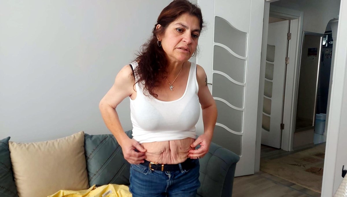 Estetik operasyonlar sonrası hayatı kabusa döndü