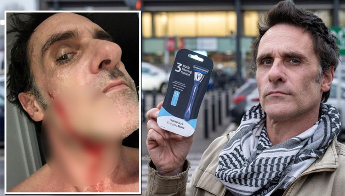 Tıraş bıçağıyla yüzünü kesti: 211 bin lira kazandı