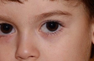 Cocuklar Icin Gunes Gozlugu Uyarisi Saglik Haberleri Ntv