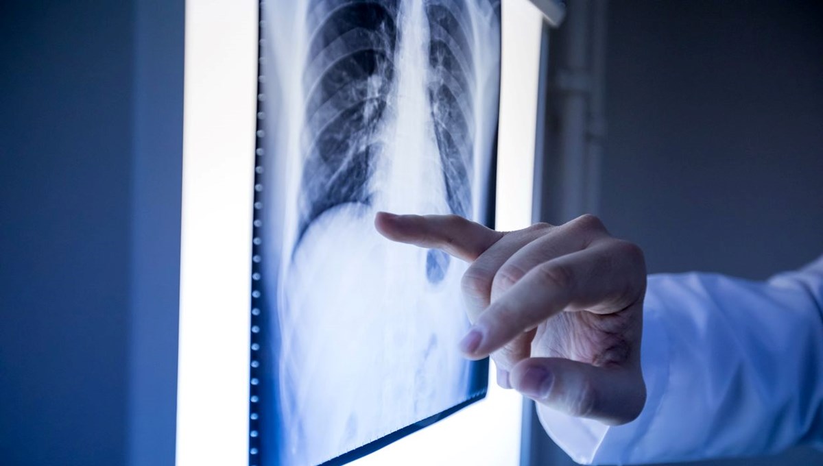 Çocukluk çağının en ölümcül kanser türü: 5 belirtiyle ortaya çıkıyor ama aileler çok geç fark ediyor Çocukluk çağının en ölümcül kanser türü: 5 belirtiyle ortaya çıkıyor ama aileler çok geç fark ediyor