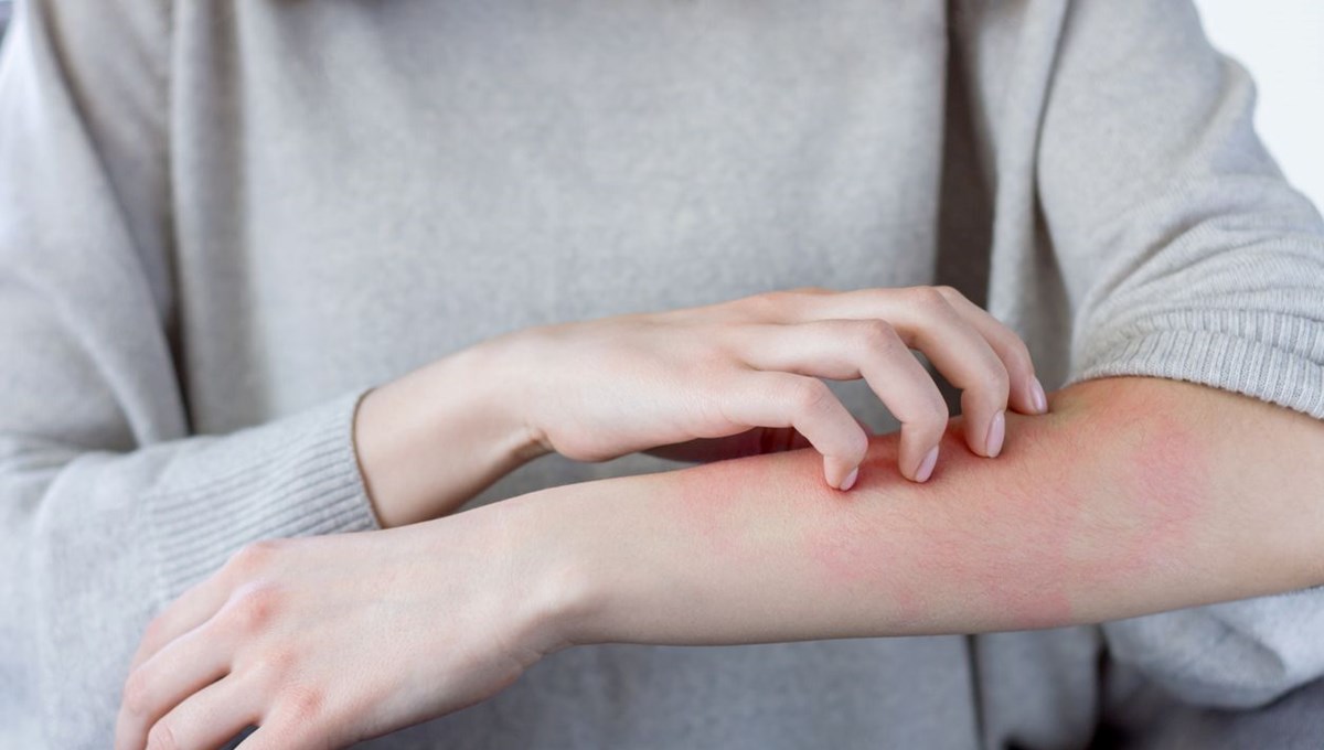 Dermatolog açıkladı: Gözden kaçırılan 2 belirti cilt kanseri işareti