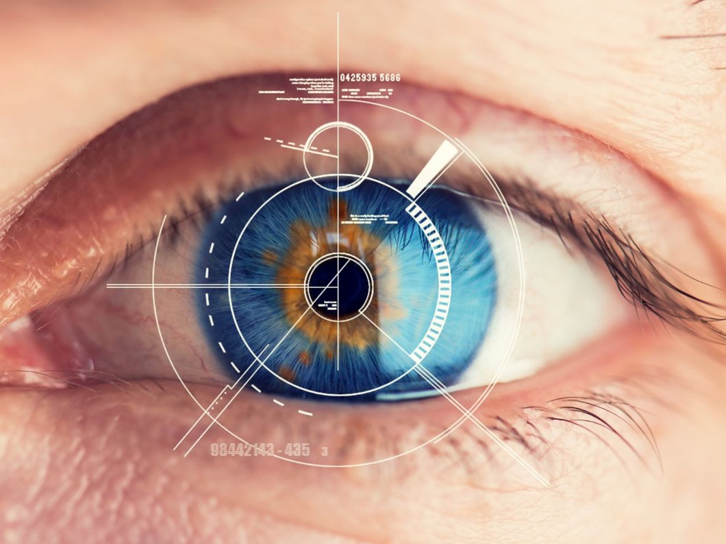 kornea nakli kimlere