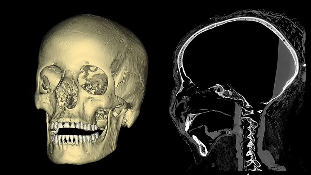 Hamile mumya 2 bin yıl sonra geri döndü: