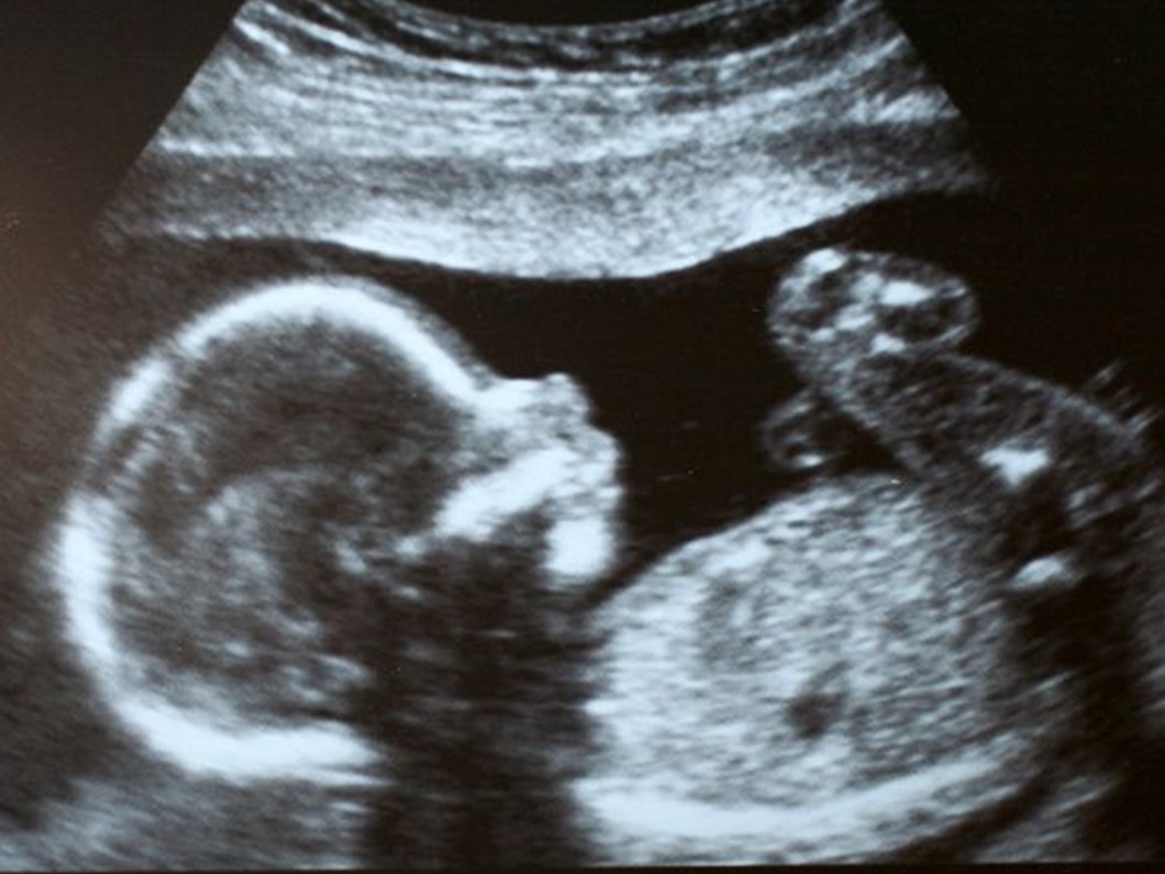 bebegin cinsiyeti ne zaman belli olur cinsiyet tayini neden gerekli saglik haberleri ntv