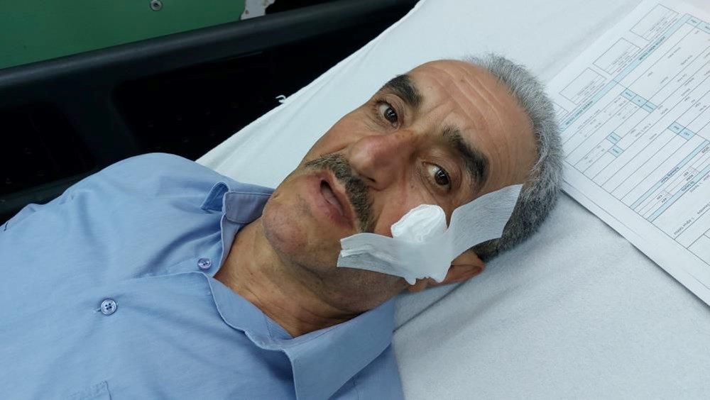 Maganda kurşunuyla yanağından vuruldu - 2