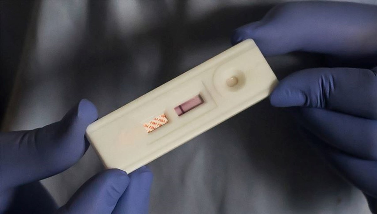 HIV'de umut veren ilaç HIV'de umut veren ilaç