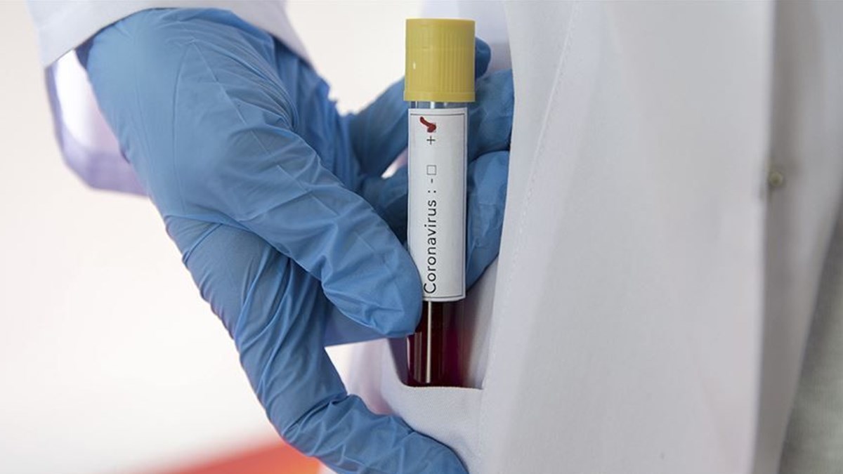 korona danisma hatti faaliyete gecti