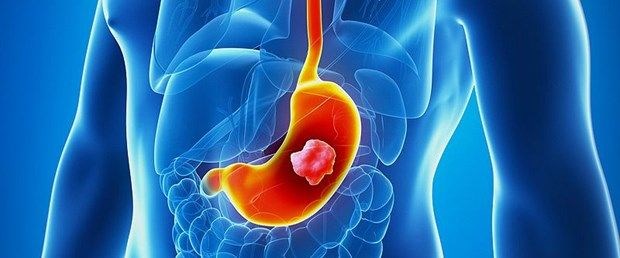 gogus agrisi neden olur gogus