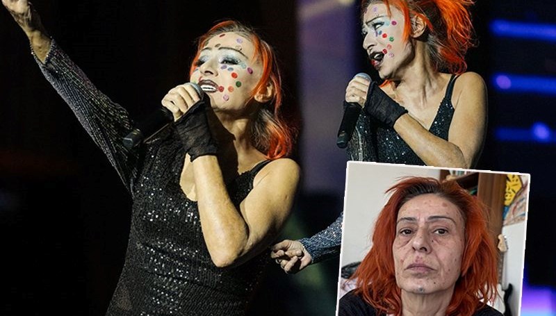 Yıldız Tilbe yüzündeki renkli beneklerle konser verdi